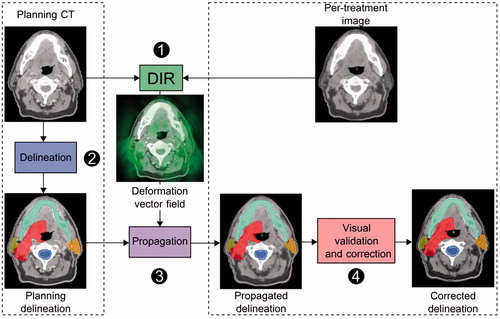 Figure 1. Workflow of delineation propagation from the planning CT to per-treatment image (head-and-neck). The planning delineations are propagated by means of the deformation vector field estimated by DIR. The propagated delineations are validated by the physician and corrected if needed. DIR: deformable image registration.