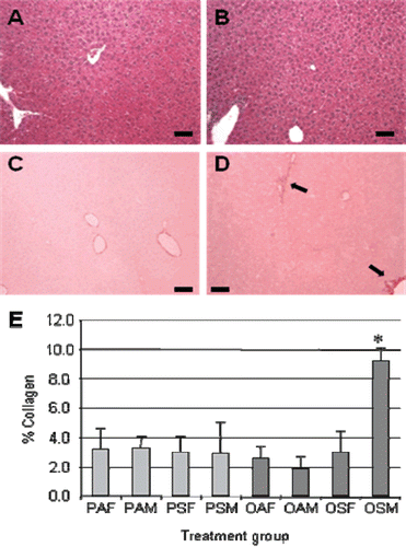 Figure 1.  Histological analyses of offspring livers. Representative images of (A and B) hematoxylin and eosin (H&E)-stained and (C and D) Sirius red-stained liver sections of (A and C) PAF and (B and D) OSM mice. In OSM mice, the increased hepatic fibrosis was primarily perivenular (D, solid arrows). (E) Bioquant colorimetric analysis of Sirius red staining indicated that combined maternal exposure to ovalbumin (OVA) and mainstream cigarette smoke (MCS) increased hepatic fibrosis in male offspring (OSM) compared with each other group. *p < 0.001 for OSM versus OAM, OSM versus PAM, and OSM versus PSM. Black bar represents 100 µm. Three mice were evaluated for each group.