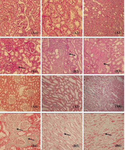 Figure 1. Pathological findings in 5/6 nephrectomized rats (periodic acid-Schiff (PAS) staining and Masson staining). (A1–A3) Sham group (PAS staining). (B1–B3) 5/6 nephrectomized group (PAS staining). (A4–A6) Sham group (Masson staining). (B4–B6) 5/6 nephrectomized group (Masson staining). The arrow points indicate glomerular sclerosis, inflammatory cell infiltration of the interstitium, protein casts, tubular atrophy, and interstitial fibrosis.