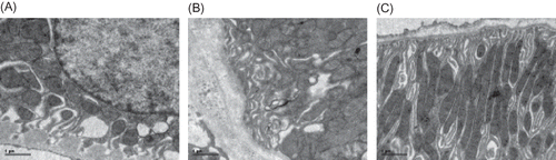 Figure 4. Electron microscopy of rat renal tubule at week 21 (×11,500). (A) The normal tubule epithelial cells and basement membrane were seen in the control group. (B) Thickening and collapse of the tubule basement membrane were found in the model group. (C) A mild thickening and collapse of the tubule basement membrane was observed in Cozaar group.