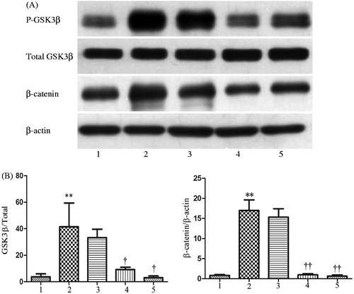 Figure 3. Dkk-1 blocked CTGF-mediated activation of canonical Wnt signaling in HK-2 cells. The cells were pretreated with various concentrations of Dkk-1 for 1 h prior to stimulation with rhCTGF (50 ng/mL). Lane 1: control group; lane 2: 50 ng/mL rhCTGF for 24 h group; lane 3: rhDkk-1 (20 ng/mL) pretreated cells prior to rhCTGF; lane 4: rhDkk-1 (200 ng/mL) pretreated cells prior to rhCTGF; lane 5: rhDkk-1 (300 ng/mL) pretreated cells prior to rhCTGF. (A) Phosphorylation of GSK3-β and protein expression of β-catenin were measured by western blotting. (B) Quantitative analysis of protein expression as measured by western blotting. **p < 0.01 versus control group, †p < 0.05 versus 50 ng/mL rhCTGF for 24 h group, ††p < 0.01 versus 50 ng/mL rhCTGF for 24 h group. All results are representative of at least three individual experiments. All results are representative of at least three individual experiments.