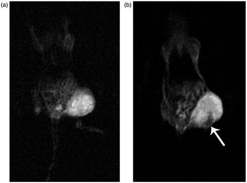 Figure 8. T2-weighted images of tumor-bearing nude mice pre-injection (a) and post-injection (b) of FA-PEI-Fe3O4.