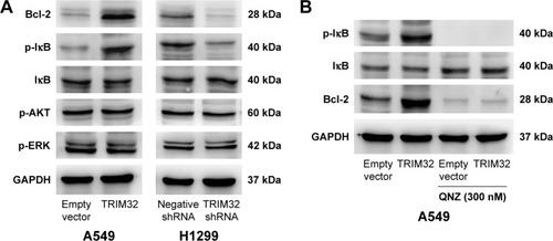 Figure 7 TRIM32 regulates NF-κB/Bcl-2 signaling.