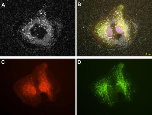 Figure 4 Retinal pigment epithelial cells (ARPE-19) incubated with 3 µg/mL AgNP. (A) Darkfield image, (B) Merged image of (C and D) and DAPI staining, (C) CellMask Orange plasma membrane staining, (D) Cells transfected with Mito-GFP (green). Magnification 600x. Pictures were done by darkfield optics using a 60-x plan Fluor objective with an iris diaphragm (NA 0.55–0.90). Reproduced from Zucker RM, Ortenzio J, Degn LL, Boyes WK. Detection of large extracellular silver nanoparticle rings observed during mitosis using darkfield microscopy. PLoS One. 2020;15(12):e0240268. The work is made available under the Creative Commons CC0 public domain dedicationCitation62.