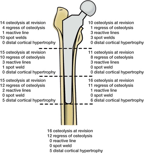 Figure 2. Radiographic findings in the different Gruen regions. Linear osteolysis at revision and remodeling after the rearthroplasty.