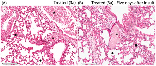 Figure 5. Histopathology of the lungs of thrombin-induced animals at the same day (A) and five days after induction (B). Integrity of alveoli and increased blood perfusion are similar for both, but microscopic emboli (*) after five days from the induction show a residual thrombi starting to disassemble. 3a derivative at 10 mM/kg (HnE staining, 8× magnification; scale bar = 600 μm).