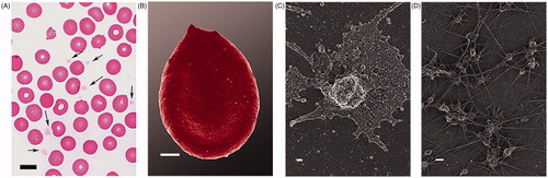 Figure 2. Light microscopy of a whole blood smear with arrows showing platelets between erythrocytes (scale = 10 μm) (A); Erythrocyte with changed ultrastructure (scale = 1 μm) (B); SEM micrograph of activated platelet with spreading and membrane changes (scale = 2 μm) (C); Numerous platelets within dense fibrin networks (scale = 2 μm) (D).