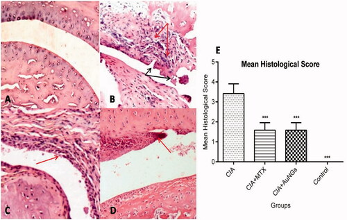 Figure 7. Histological examination of swollen paw. Normal architecture of knee joints in control rats (A), massive influx of inflammatory cells (Red arrow) and cartilage destruction (Black arrow) in CIA rats (B), show significant less influx of inflammatory cells and inflammation in MTX (C) and AuNGs treated rats (D). Mean histological score is shown in (E). ***p < .05.