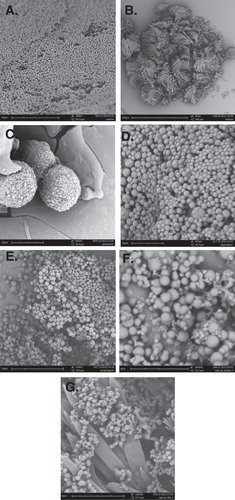 Figure 2. Antisolvent vapor precipitated particles: (A) lactose microspheres; (B) lactose micro crystals; (C) lactose + fish oil; (D) magnesium sulfate; (E) lactose + magnesium sulfate; (F) whey protein isolate microspheres and (G) whey protein isolate + lactose segregated particles are shown.