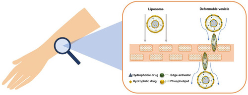 Figure 3 Topical treatment using liposomes or deformable vesicles. Both the carriers are able to deliver hydrophobic and hydrophilic compounds.