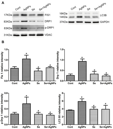 Figure 6 Western blotting of mitochondrial fission and autophagy markers. (A) The representative Western blot showing Drp1, p-Drp1, Fis1 and LC3B levels. VDAC and GAPDH served as the internal loading control for mitochondrial and whole protein, respectively. (B) The bar graph showing semiquantitative band intensity ratio from Drp1, p-Drp1, Fis1 to LC3B.