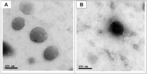 Figure 1 TEM images of the sertaconazole-loaded vesicles displaying (A) liposomes, (B) mucoadhesive liposomes.