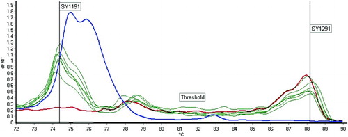 Figure 1.  Examples of real-time HRM analysis results. The figure shows an example of duplex-PCR for SY1191 and SY1291. The red curve represents a subject with SY1191 deletion, while the blue curve represents a subject with SY129 deletion. The black curve represents the NTC. All the green curves represent subjects without any deletions. HRM: high resolution melt; NTC: non-template control.