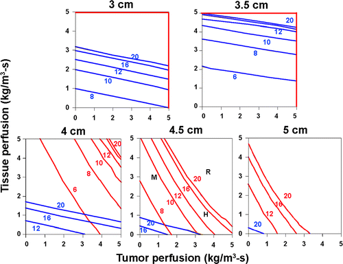 Figure 8. Effect of perfusion on the time required to achieve ablation for a cluster electrode. The 50°C isotherm for achieving complete tumor ablation without (red isobars) and with (blue isobars) a 5-mm ablative margin was plotted for different RF ablation times (6–20 min) and different tumor sizes (3–5 cm diameter) and varied inner and outer perfusion 0–5 kg/m3-s using a 2.5-cm cluster electrode. The approximate inner/outer perfusions for varying types of commonly treated tumors overlay the 4.5-cm tumor surface response contour and are represented as: Colorectal metastases to normal liver (M), renal cell carcinoma (R), and hepatocellular carcinoma (H). The time and ability to completely treat tumor or achieve a 5-mm ablative margin varies considerably based upon tumor type and size. In this scenario, achieving complete ablation of the colorectal metastasis would take 10 min, while the HCC would require greater than 12 min of heating and the RCC in excess of 20 min.