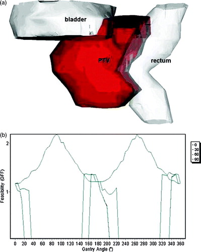 Figure 7.  The prostate case. The rectum and the bladder have been delineated as OAR's, with assigned weights of 1 and 0.5 respectively. (a) 3D view of the contoured anatomy. (b) Feasibility graph for the gantry angles of four table angles (0°, 30°, 60° and 90°).