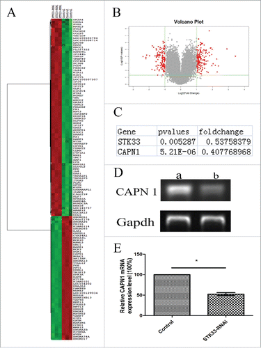 Figure 2. Differential gene expression values in Fadu cells upon STK33-RNAi. (A) Composite hierarchical and conditional clustering of statistically significant alterations in gene expression from Fadu and STK33-RNAi Fadu cells. Gene expression levels are shown by red for high and green for low expressing genes. (B) Volcano plot showing an overview of gene expression in Fadu and STK33-RNAi Fadu cells. Each dot represented the mean regulation value (log2-fold change of STK33-RNAi versus control cells) of 3 replicas and the p-value(-log10 of p-values). x-axis: Log2(Fold change), y-axis: -log10(p-value). Negative values indicated a decrease and positive values showed an increase in gene expression upon fusion gene knockdown. Red Region: p-value<0 .05, Fold Change≥2 . (C) Changes of selected gene in microarray. (D) STK33-RNAi infection led to a significant decrease in CAPN1 mRNA expression compared with that in the normal Fadu cells. a) control group, b) STK33-RNAi group. (E) Data represent the mean± SEM, *p < 0 .05.
