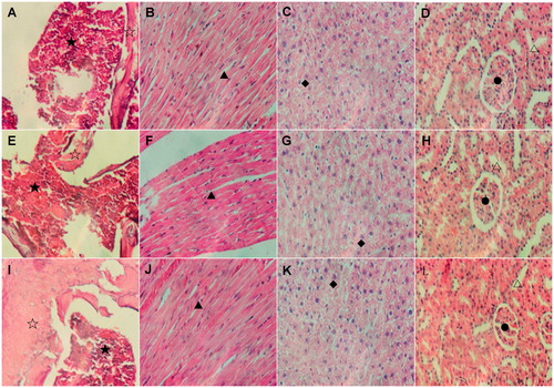 Figure 1. Pathological analyses of the vital organs of Wistar rats in different groups. Wistar rats of both ShD treated groups and control groups were kept for 90 or 180 days, then they were sacrificed and the organs were removed for pathological analyses. A to D: sternum, heart, liver and kidney of rats without treatment. E to H: sternum, heart, liver and kidney of rats treated with solvent. I to L: sternum, heart, liver and kidney of rats treated with ShD at the concentration of 800 mg/kg. No significant abnormality and difference were found among the different groups. ☆: bone marrow; ⋆: bone; ▴:myocardial cell; ♦: hepatocyte; •: glomerulus; Δ: renal tubule.