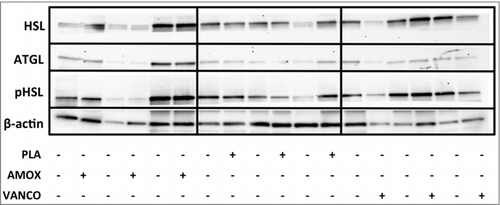 Figure 4. Representative Western Blot for lipolytic markers in human adipose tissue. Membranes were probed with antibodies directed against total ATGL, total HSL, phosphorylated HSL (pHSL) on Ser563 (corresponding to human Ser552) and β-actin was used as a loading control. A subset of 3 subjects per group is shown.