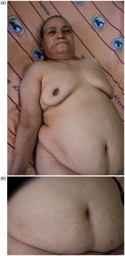 Figure 5. (a and b) The patient appearance following the treatment.