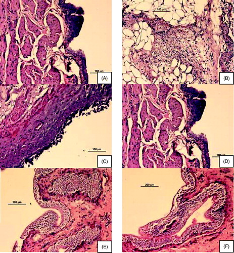 Figure 7. Histologic images of bladders in different groups of rats. (A) control; (B and C) acetic acid-induced overactive bladder; (D) oxybutynin treated (p.o.); (E) P3 gel-treated; (F) P4 gel-treated.
