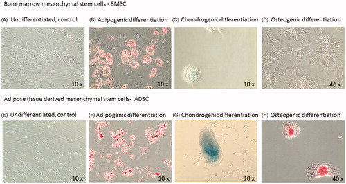 Figure 1. Representative images from differentiated mesenchymal stem cells. A–D: bone marrow mesenchymal cells, BMSCs and E–H: adipose derived mesenchymal cells, ADSCs. Panel B and F are stained with Red Oil for adipocyte identification. Panel C and G are stained with Alcian Blue for chondrocyte identification. Panel D and H are stained with Alizarian Red for osteoblast identification.