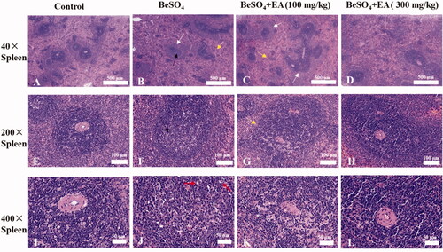 Figure 5. Histopathological observations showing effects of EA on BeSO4-induced changes in spleen/Spleen tissues were subjected to H&E staining. Microscopic images were taken at a magnification of 40 × (A–D), 200 × (E–H) and 400 × (I–L) for the spleen. White arrow: thickening of the marginal area; Black arrow: localized central dilatation of the spleen nodules; Yellow arrow: red pulp with blood stasis; Red arrow: nuclear fragmentation.