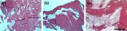 Figure 11 Histological analysis images at days 1–3 (D1–D3).Notes: Scale bar 1 mm.