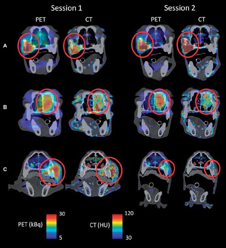 Figure 1. Precontrast coronal CT images of patient A–C with PET activity and CT contrast enhancement obtained one minute post injection given as overlay. Level/window settings (see color bars) are indicated. The red circle indicates the location of the tumor. Images were obtained at two sessions; one prior to and one after the course of fractionated radiotherapy (session 1 and 2, respectively).