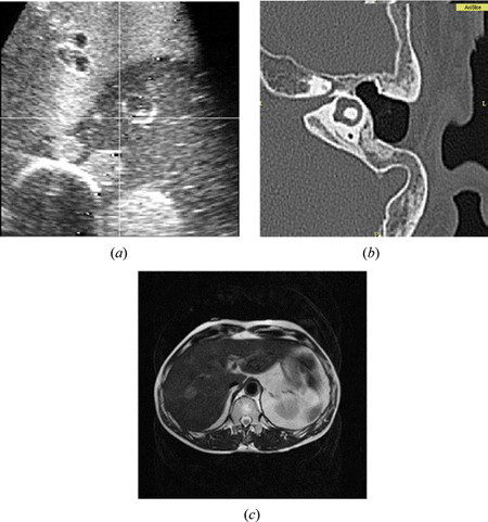 Figure 1 Medical images; (a) US for liver phantom, (b) CT for ear, and (c) MRI for abdomen (color figure available online).