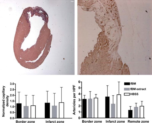Figure 3. Basal section at midventricular short axis orientation demonstrates basal extent of myocardial infarct including infarct, border, and remote zone at the same slice from an animal with fBM treatment. Infarct size was measured by applying picrosirius staining (left) and capillary density by CD31 staining (right). Capillary densities at border zone and infarct zone are normalized individually to remote zone capillary density (left). Mean arteriole density in border zone, infarct zone, and remote zone measured by fluorescent microscopy from five high-power (40 ×) fields (right). Data are expressed as mean ± SD. All P values are non-significant (>0.05).