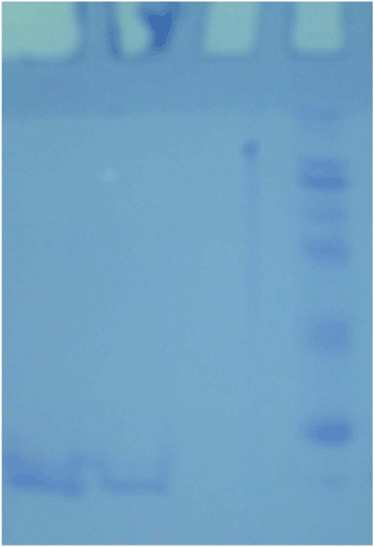 Figure 1.  Lane (1) human tumour gastric GST. Lane (2) human nontumour gastric GST. Lane (3) standard proteins (E. coli β-galactosidase (116 kDa)), rabbit phosphorylase B (97.4 kDa), bovine serum albumin (66 kDa), chicken ovalbumin (45 kDa) and bovine carbonic anhydrase (29 kDa) SDS-PAGE analysis of purified.
