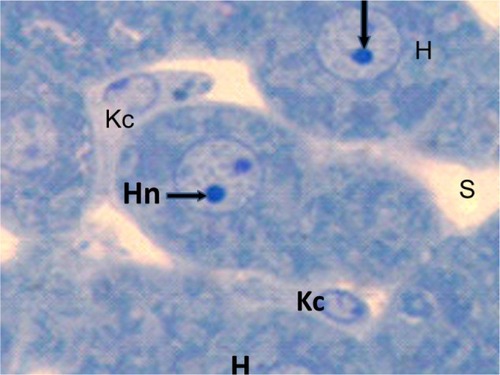 Figure 12 Semithin section of liver tissue from the treated group showing swollen hepatic cells with narrowing of the sinusoidal lumen and hypertrophied Kupffer cells. Scale bar 50 μm.Abbreviations: H, hepatic cells; Hn, hypertrophied nuclei; Kc, Kupffer cells; s, sinusoidal lumen.
