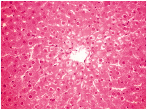 Figure 3. CCl4 + MERV-100 mg/kg-treated group rat liver section showing moderate hepatoprotective activity.