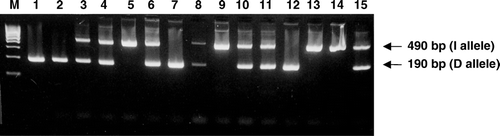 Figure 1.  Determination of ACE I/D polymorphism genotypes by PCR amplification. The presence of a 490 bp fragment (I allele) and a 190 bp fragment (D allele) indicate the possible genotypes DD, ID and II. M: molecular weight marker; 1, 2, 7 and 12: DD homozygotes; 3, 4, 6, 8, 10, 11 and 15: ID heterozygotes; 5, 9, 13 and 14: II homozygotes.