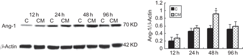 FIGURE 5. Effect of CM on Ang-1 protein expression. Production of Ang-1 by EPCs in CM group was significantly greater than that in control group and became apparent and reached the maximum at 48 h. C (control group): conditioned medium from normoxic condition; CM: conditioned medium from hypoxic condition; β-actin was used as a housekeeping protein. Data are presented as the mean ± SD. n = 5. *p < 0.01 compared with control group.