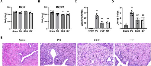 Figure 2. The anti-PD effects of GGD on PD model rat. (A) The weight of the rat on day 1 of the experiment. (B) The weight of the rat on day 10. (C–E) The writhing numbers (C), uterine index (D), and pathological changes in the uterine tissue (E) in each group, as determined using H&E staining, scale bar = 50 µM. The black arrow represents the lesion. Data are presented as mean ± SD (n = 6). **, p < 0.01 vs. Sham group, ##, p < 0.01 vs. GGD group (Tukey–Kramer’s test). PD: Primary dysmenorrhoea; GGD: Ge-Gen decoction; IBF: Ibuprofen.
