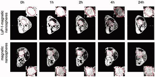 Figure 2. MR scan of orthotopic pancreatic tumor bearing mice at 3T. The T2 weight MR images of orthotopic pancreatic cancer (circled by red dash line) in C57BL/6 mice before and after administration of the Fe3O4@SiO2-FITC@mSiO2-LyP-1 or Fe3O4@SiO2-FITC@mSiO2 systemically at different time point. The inset is the enlarged pictures of corresponding tumor region (adapted from Jiang et al., Citation2017).