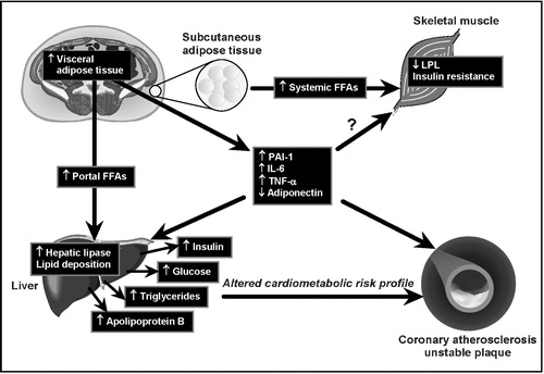 Figure 3. Working mechanistic model for the relation of excess visceral adipose tissue accumulation to the insulin resistant, dyslipidemic, prothrombotic and proinflammatory profile of abdominally obese patients.