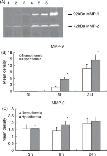 Figure 5. Gelatine zymogram shows the activities of MMP-2 (72 kDa) and MMP-9 (92 kDa) in the ischaemic injured brain collected from normothermic and hyperthermic rats. Lane 1: 3 h after normothermia; lane 2: 3 h after hyperthermia; lane 3: 6 h after normothermia; lane 4: 6 h after hyperthermia; lane 5: 24 h after normothermia; lane 6: 24 h after hyperthermia (A). Histograms show the densitometric analyses of MMP-2 (B) and MMP-9 (C) activities. *p < 0.05 compared with the normothermic group.