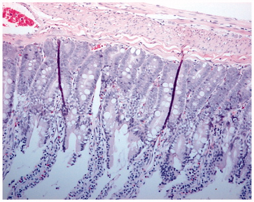 Figure 3. Hematoxylin and eosin staining of intestine tissue sections (200×) of Shed blood reperfusion group after 90 min ischemia and 1 h resuscitation.