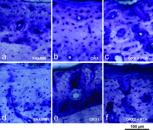 Figure 7.  Tibia cortical bone from male rats. Endosteal surfaces in male rats as viewed in 100 μm-thick ground sections stained with toluidine blue from preventive experiment (a–c) and from intervention experiment (d–f). Note that ORX1 cortical bone has a wide osteoid seam in an intracortical (remodelled) osteon (e), and that PTH treatment produces new bone formation both in prevention (c) and intervention experiments (f).