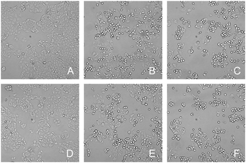 Figure 6. Morphologic changes of MCF-7 cells. (A) ctrl, (B) 0.5 μM EVO, (C) 1 μM EVO, (D) PLGA (the equivalent amount of PLGA in 1 μM EVO-PLGA NPs), (E) 0.5 μM EVO-PLGA NPs, (F) 1 μM EVO-PLGA NPs. Microscope observation showed that EVO and EVO-PLGA NPs treatment induced morphologic changes in MCF-7 cells.