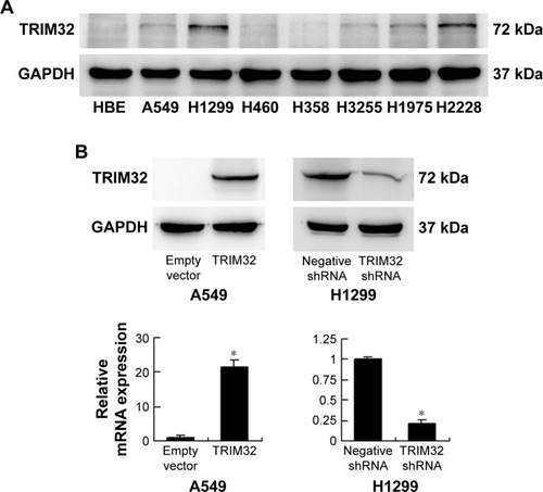 Figure 3 Expression of TRIM32 in NSCLC cell lines.