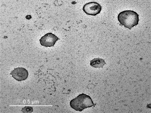 Figure 1 Transmission electron photomicrographs of NF-loaded niosomes.