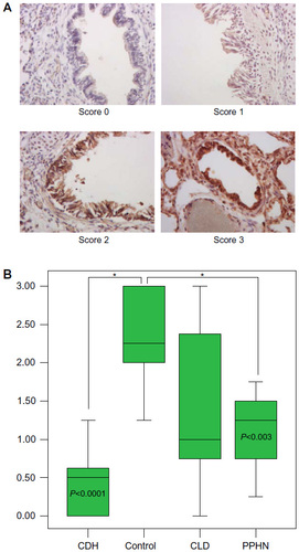 Figure 3 The NT-3 representative slide-staining (×400) scores (0–3) (A) and the corresponding intensity staining scores (B) at the bronchiole level.