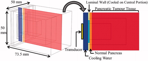 Figure 3. 3D generalised pancreatic tumour model employed for parametric studies of endoluminal ultrasound thermal therapy.