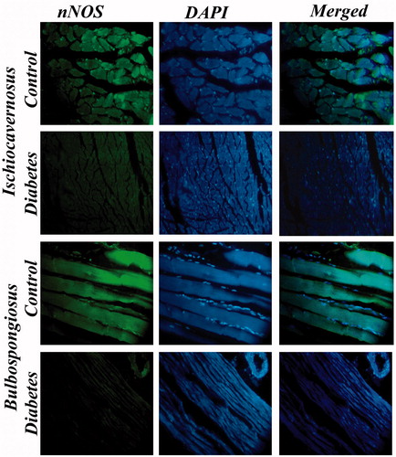 Figure 11. Immunostaining for nNOS IC and BS muscles of control and diabetic rats. Expression of nNOS in diabetic rat was severely diminished in these muscles when compared with control. 40×.