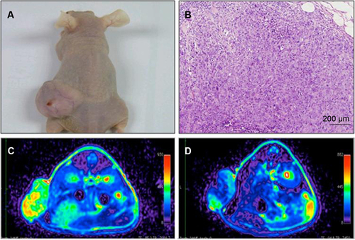 Figure S5 In vivo MR images of HT29 subcutaneous xenografts after intravenous injection of USPIO-CD133 Ab.Notes: Photograph of tumor-bearing mouse (A); H&E staining of xenografted tumor at 100× magnification (B); FSE T2-weighted MR images of preinjection (C) and postinjection of USPIO-CD133 Ab for 24 hours (D).Abbreviations: FSE, fast spin echo; H&E, hematoxylin and eosin; MR, magnetic resonance; USPIO, ultrasmall SPIO; USPIO-CD133 Ab, USPIO conjugated with anti-CD133 antibodies.