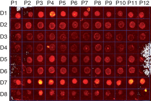 Figure 2. Protein detection using fluorescence. Membrane proteins P1–P12 in detergents D1–D8 were labelled with the fluorescent EZQ dye and visualized using an In Vivo Imaging System at excitation and emission energies of 465 and 620 nm, respectively. This Figure is reproduced in colour in the online version of Molecular Membrane Biology.