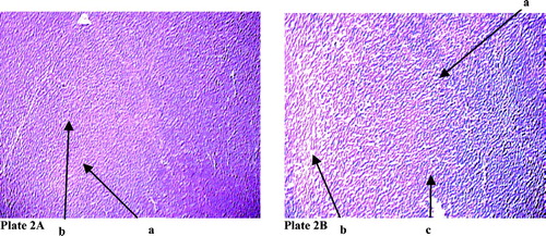 Plate 2 (A) Changes in the arrangement of cortex and medulla in thymic lobule in rat after sodium fluoride treatment. Hematoxylin and eosin stain (100 X). Arrow denoted by ‘a’ mark indicates the medullary part of the thymic lobule ‘b’ mark cortical part of the thymic lobule. (B) Arrow with ‘a’ mark indicates derangement in the cortex and medullary part of the thymic lobule, ‘b’ mark arrow indicates vaculation, ‘c’ mark arrow indicates pigmentation.